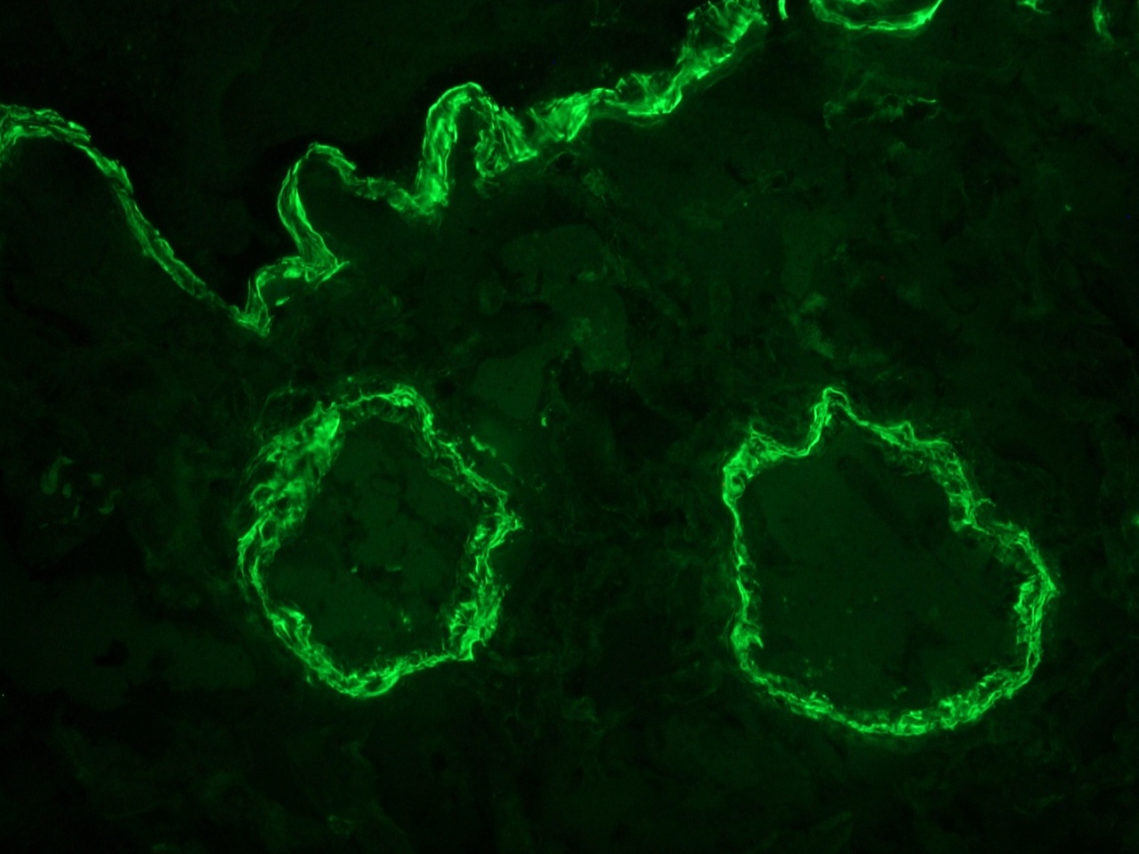 Figure 2. Indirect immunofluoresence staining of a frozen section of human colon using MUB0100P (clone 1A4) showing strong reactivity on the smooth muscle cells at a dilution of 1:500.